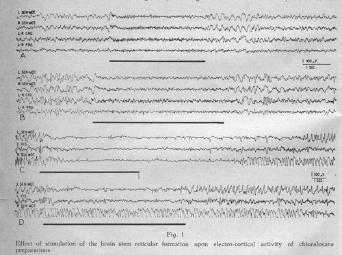 9/ - Una figura dall'articolo di Moruzzi e Magoun del 1949